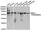 Monoglyceride Lipase antibody, LS-C334853, Lifespan Biosciences, Western Blot image 