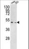 Transmembrane Serine Protease 3 antibody, LS-C162043, Lifespan Biosciences, Western Blot image 