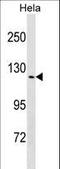 Transient Receptor Potential Cation Channel Subfamily V Member 4 antibody, LS-C157286, Lifespan Biosciences, Western Blot image 