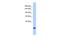 Protein SSX8 antibody, A17678, Boster Biological Technology, Western Blot image 