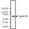 Cyclin T2 antibody, PA5-22200, Invitrogen Antibodies, Western Blot image 