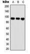 Aryl Hydrocarbon Receptor Nuclear Translocator antibody, LS-C358415, Lifespan Biosciences, Western Blot image 