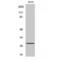 CD58 Molecule antibody, LS-C382552, Lifespan Biosciences, Western Blot image 