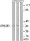 Olfactory Receptor Family 52 Subfamily E Member 1 (Gene/Pseudogene) antibody, A30885, Boster Biological Technology, Western Blot image 