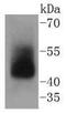 Adiponectin Receptor 1 antibody, A01869-1, Boster Biological Technology, Western Blot image 