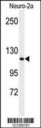 Arginine-Glutamic Acid Dipeptide Repeats antibody, MBS9213244, MyBioSource, Western Blot image 