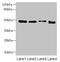 DNA Damage Inducible 1 Homolog 2 antibody, CSB-PA732937LA01HU, Cusabio, Western Blot image 