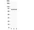 Integrin Subunit Beta 2 antibody, R30292, NSJ Bioreagents, Western Blot image 