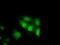 Tetratricopeptide Repeat Domain 32 antibody, M19194, Boster Biological Technology, Immunofluorescence image 