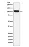 Itchy E3 Ubiquitin Protein Ligase antibody, M00195-2, Boster Biological Technology, Western Blot image 