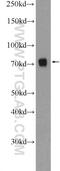 SUMO Specific Peptidase 1 antibody, 25349-1-AP, Proteintech Group, Western Blot image 