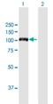 Diaphanous Related Formin 3 antibody, H00081624-B01P, Novus Biologicals, Western Blot image 