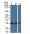 Acid Phosphatase 1 antibody, LS-C417941, Lifespan Biosciences, Western Blot image 