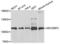 SECIS Binding Protein 2 antibody, LS-C346122, Lifespan Biosciences, Western Blot image 