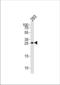 TGFB Induced Factor Homeobox 2 antibody, TA324567, Origene, Western Blot image 