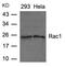 Rac Family Small GTPase 1 antibody, 79-580, ProSci, Western Blot image 