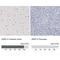 Zinc Finger E-Box Binding Homeobox 2 antibody, NBP1-82991, Novus Biologicals, Immunohistochemistry paraffin image 