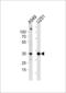 Ankyrin Repeat And SOCS Box Containing 9 antibody, LS-C203963, Lifespan Biosciences, Western Blot image 