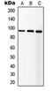 Insulin Like Growth Factor 1 Receptor antibody, orb214087, Biorbyt, Western Blot image 