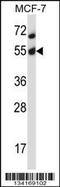 AKT Serine/Threonine Kinase 2 antibody, MBS9213803, MyBioSource, Western Blot image 