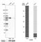 Acyl-CoA Binding Domain Containing 5 antibody, HPA012145, Atlas Antibodies, Western Blot image 