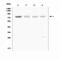 ATP Binding Cassette Subfamily G Member 8 antibody, A01482-2, Boster Biological Technology, Western Blot image 