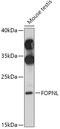 FGFR1OP N-Terminal Like antibody, 18-117, ProSci, Western Blot image 