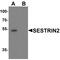 Sestrin 2 antibody, PA5-72834, Invitrogen Antibodies, Western Blot image 