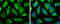 Citrin antibody, GTX109001, GeneTex, Immunofluorescence image 
