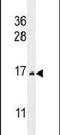 Cystatin 9 antibody, PA5-24535, Invitrogen Antibodies, Western Blot image 