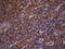 Mitogen-Activated Protein Kinase Kinase Kinase 8 antibody, LS-C791654, Lifespan Biosciences, Immunohistochemistry paraffin image 