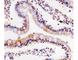 Cyclin Dependent Kinase 4 antibody, F52368-0.4ML, NSJ Bioreagents, Immunohistochemistry frozen image 