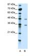 Interferon Regulatory Factor 6 antibody, orb330011, Biorbyt, Western Blot image 