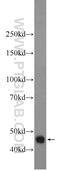 Deoxyribonuclease 2 Beta antibody, 22652-1-AP, Proteintech Group, Western Blot image 