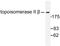 DNA Topoisomerase II Beta antibody, LS-C176355, Lifespan Biosciences, Western Blot image 