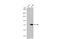 IL2 Inducible T Cell Kinase antibody, GTX636666, GeneTex, Western Blot image 