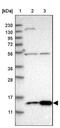 SRA Stem-Loop Interacting RNA Binding Protein antibody, NBP1-85285, Novus Biologicals, Western Blot image 