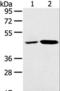 Sorting Nexin 5 antibody, LS-C406833, Lifespan Biosciences, Western Blot image 