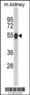 Catalase antibody, MBS9205639, MyBioSource, Western Blot image 