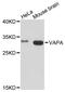 VAMP Associated Protein A antibody, A05329, Boster Biological Technology, Western Blot image 