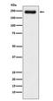 Laminin Subunit Gamma 1 antibody, M03522-1, Boster Biological Technology, Western Blot image 