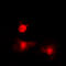 Histone Deacetylase 8 antibody, GTX32364, GeneTex, Immunofluorescence image 