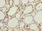 Peptidyl Arginine Deiminase 3 antibody, LS-C398265, Lifespan Biosciences, Immunohistochemistry paraffin image 