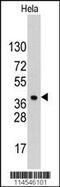 Heparin Binding Growth Factor antibody, 62-269, ProSci, Western Blot image 