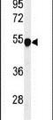 Phenylalanine Hydroxylase antibody, PA5-24843, Invitrogen Antibodies, Western Blot image 