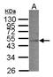 Acyl-CoA Dehydrogenase Short Chain antibody, NBP1-32032, Novus Biologicals, Western Blot image 