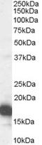 Cyclin-dependent kinase inhibitor 2A, isoform 1 antibody, orb19161, Biorbyt, Western Blot image 