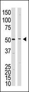 Presenilin 1 antibody, MBS9204178, MyBioSource, Western Blot image 