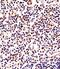 Lymphocyte Activating 3 antibody, GTX81605, GeneTex, Immunohistochemistry paraffin image 