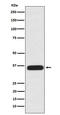 PDZ And LIM Domain 1 antibody, M04832-1, Boster Biological Technology, Western Blot image 